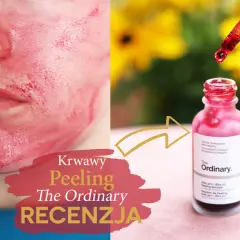 Krwawy peeling The Ordinary na twarzy i buteleczka z pipetką. Recenzja produktu.