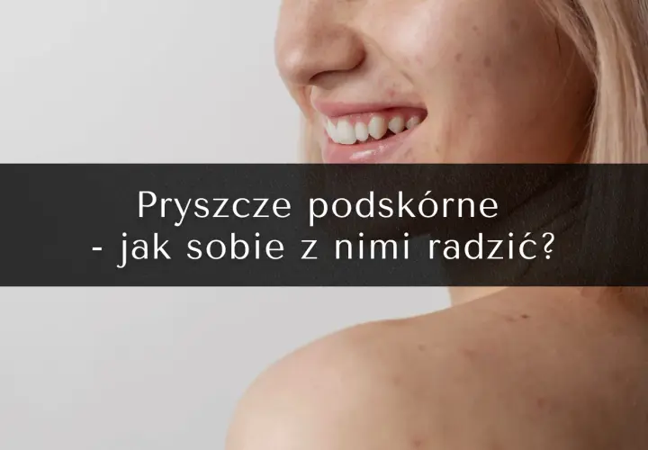 Zbliżenie na twarz i ramię z widocznymi niedoskonałościami. Tekst: "Pryszcze podskórne - jak sobie z nimi radzić?".
