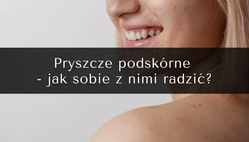 Zbliżenie na twarz i ramię z widocznymi niedoskonałościami. Tekst: "Pryszcze podskórne - jak sobie z nimi radzić?".