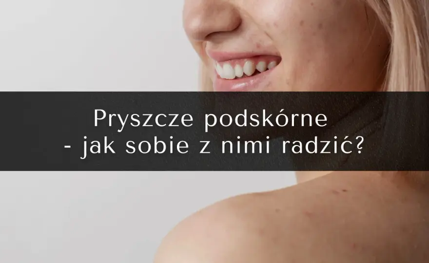 Jak pozbyć się pryszcza pod skórą? Skuteczne sposoby i zapobieganie