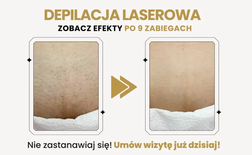 Depilacja bikini: Jak wybrać idealną metodę dla siebie?