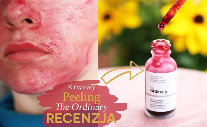 The Ordinary "Krwawy Peeling": Jak używać bezpiecznie?