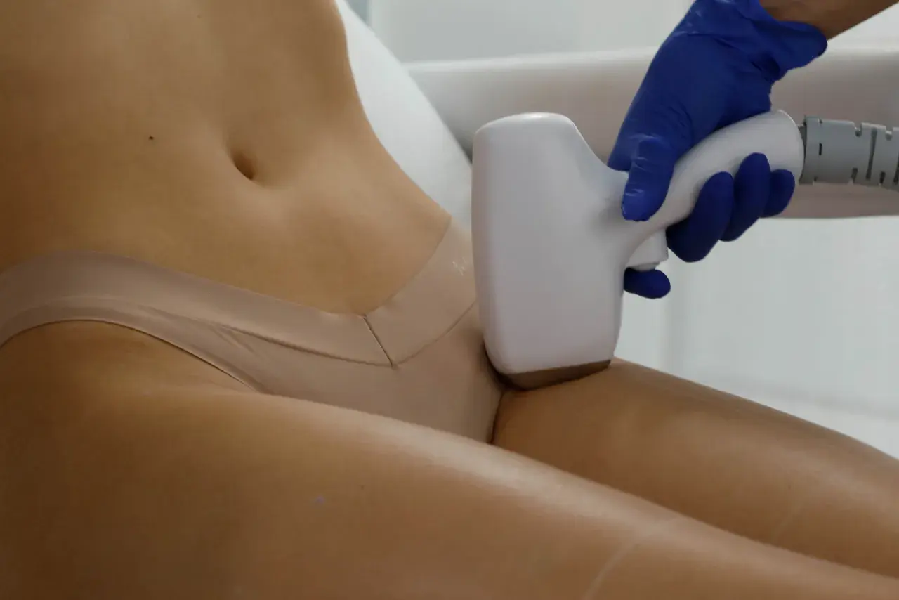Zabieg depilacji laserowej bikini. Dłoń w niebieskiej rękawiczce trzyma depilator, przykładając go do skóry.