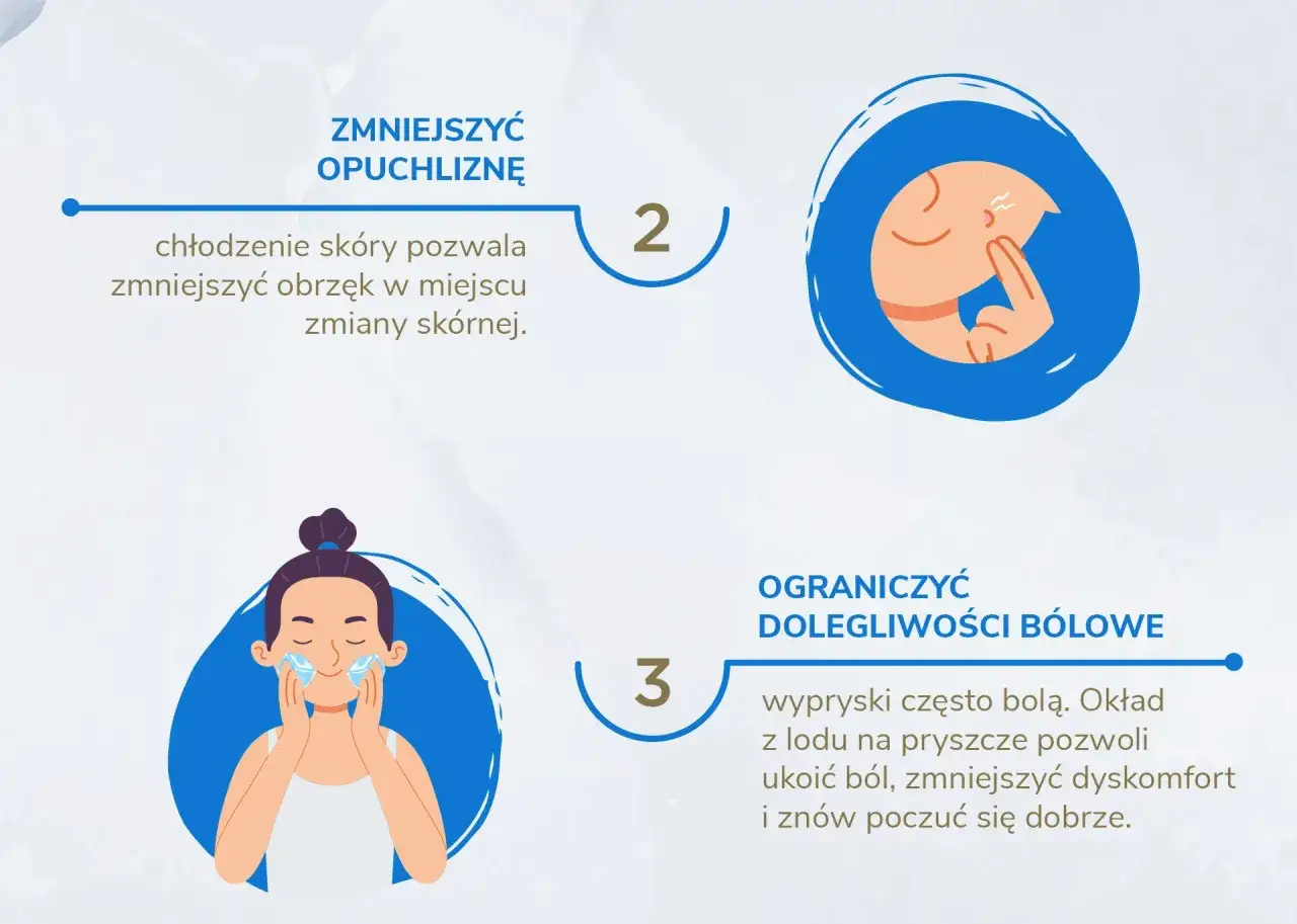 Chłodzenie sk&oacute;ry i okłady z lodu pomogą Ci jak pozbyć się pryszczy w jeden dzień, zmniejszając obrzęk i b&oacute;l.